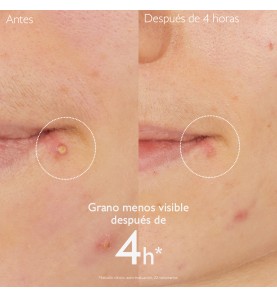 CAUDALIE VINOPURE STOPGRANOS SALICILICO 15ML