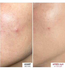 ERBORIAN CENTELLA SOS PATCH