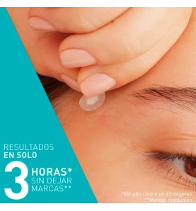 PARCHES CONTROL IMPERFECCIONES CERAVE 22 UNIDADE